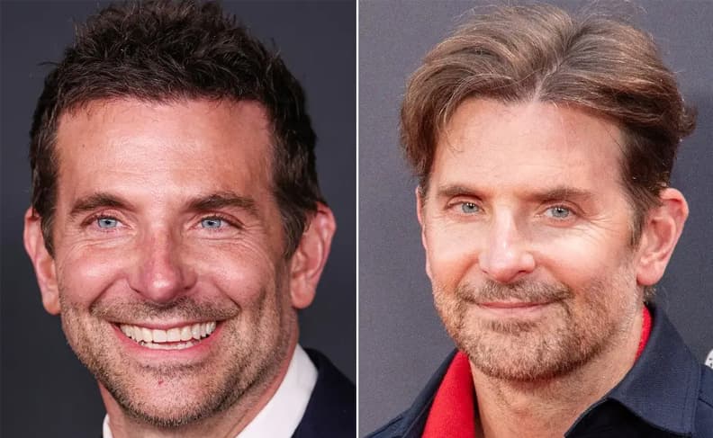 Bradley Cooper after unnatural blepharoplasty surgery. (Photo -Radaronline)