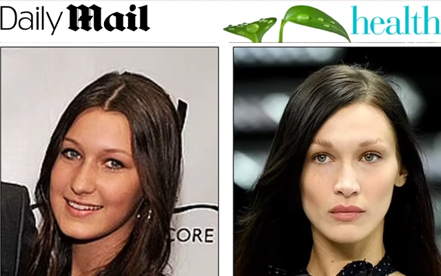 Daily Mail: Celebrities Who Deny Plastic Surgery